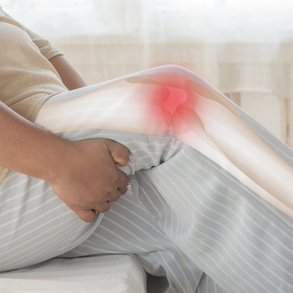 Luxación de Rodilla